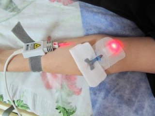 laser_krov_02 laser_krov_02