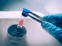 Эффективность применения стволовых клеток в пластической хирургии