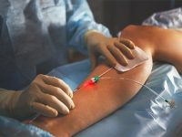 Эффективность лазерной терапии при лечении патологий сосудов нижних конечностей