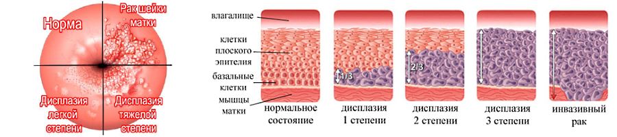 Типы вагин фото