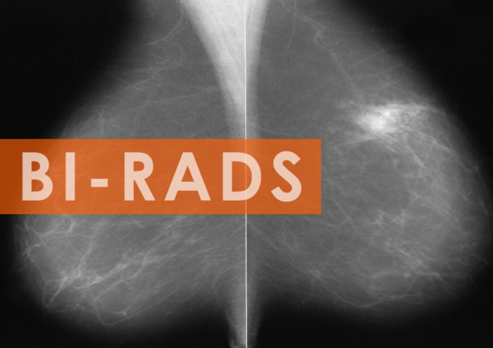 Lung rads 2. Шкала bi-rads. Bi rads 2. Маммография шкала bi-rads. Критерии bi-rads 2 при маммографическом исследовании.
