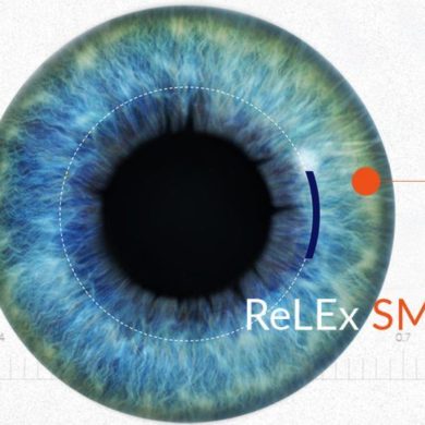 ReLEx SMILE лазерная коррекция зрения