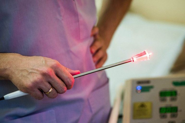 Низкоинтенсивная лазерная терапия (НИЛТ)