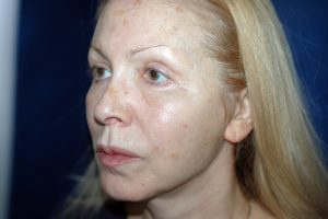 Как моя свекровь сделала пластическую операцию