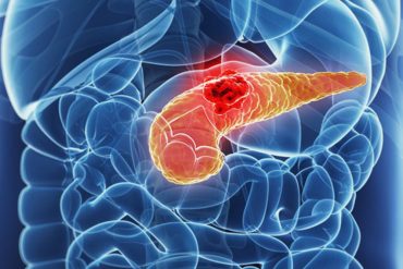 Потенциальное новое комбинированное лечение рака поджелудочной железы