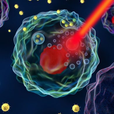 Лазерная технология помогают в изучении раковых клеток