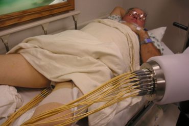 Новый метод радиотерапии для лечения рака простаты