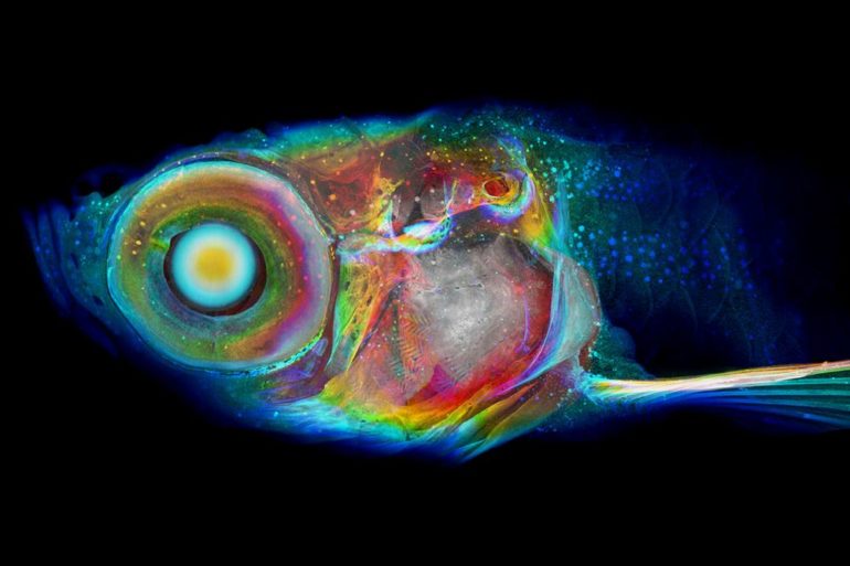 Рентгеновская гистотомография - дальнейшее развитие КТ диагностики