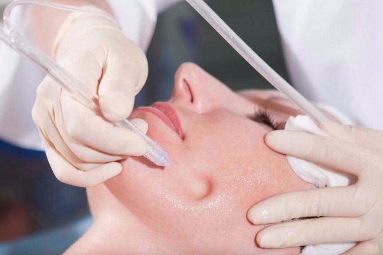 Газожидкостный пилинг лица