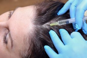 Дутастерид мезотерапия для лечения андрогенетической алопеции