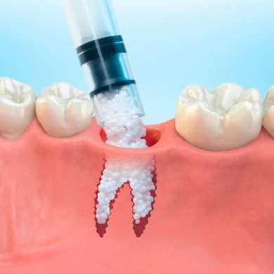 Регенерация зубов - возможно ли такое?