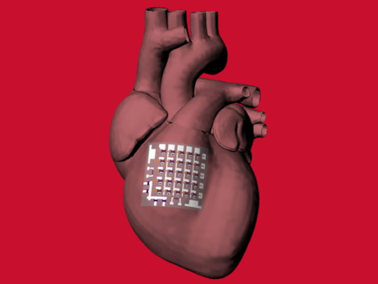 Конформный биоэлектронный пластырь контролирует здоровье сердца