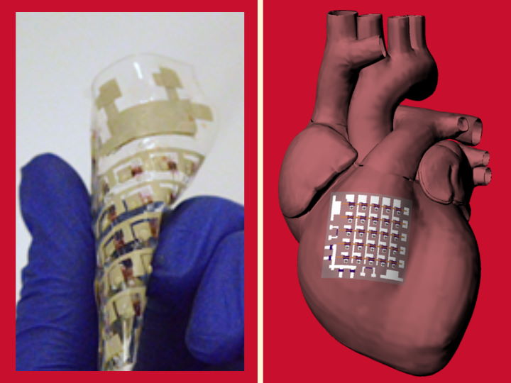 Конформный биоэлектронный пластырь контролирует здоровье сердца