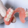 Сколько стоит поставить зубные протезы?