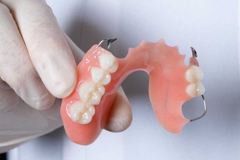 Сколько стоит поставить зубные протезы?