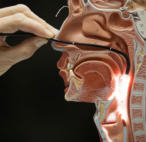 Эндоскопия носа и гортани