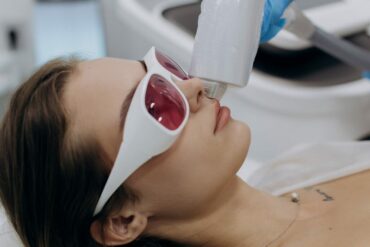 Лазерная эпиляция при гирсутизме и гипертрихозе: полное руководство