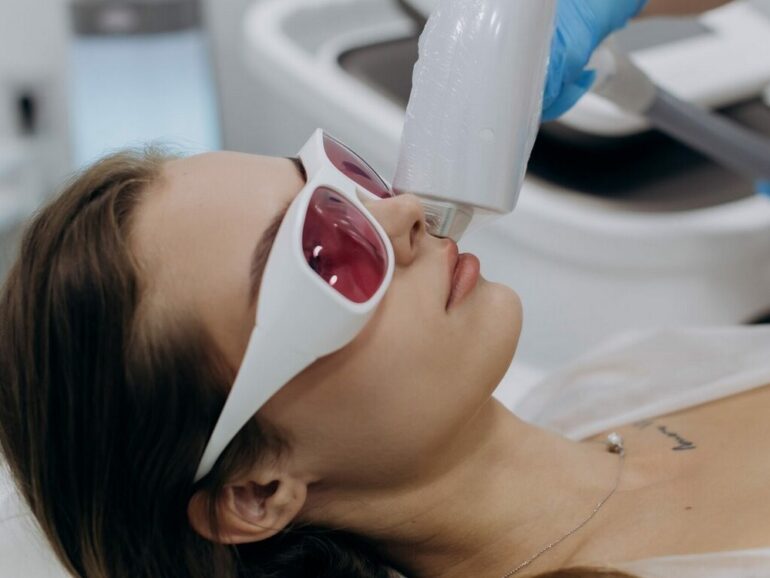 Лазерная эпиляция при гирсутизме и гипертрихозе: полное руководство