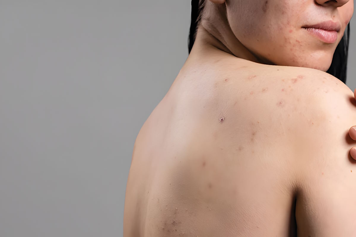 Состояние кожи и местные противопоказания