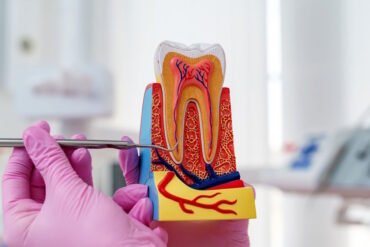 5 причин почему удаляют нерв даже если зуб совершенно не болит