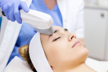 Фотоомоложение лица